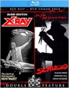 X-Ray / Schizoid